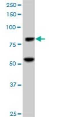 Western Blot: ZNF624 Antibody [H00057547-B01P]