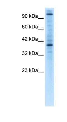 Western Blot: ZNF624 Antibody [NBP1-80015]