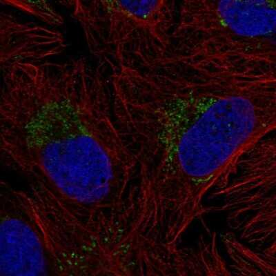 Immunocytochemistry/ Immunofluorescence: ZNF625 Antibody [NBP2-55949]