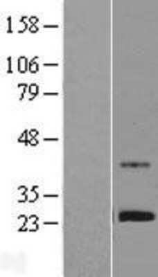 Western Blot: ZNF625 Overexpression Lysate [NBL1-18212]