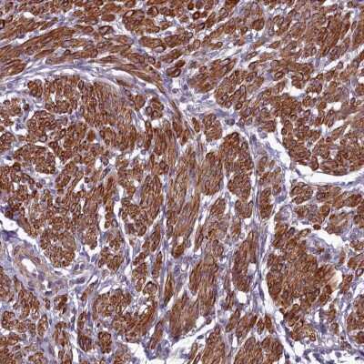 Immunohistochemistry-Paraffin: ZNF626 Antibody [NBP2-13588]