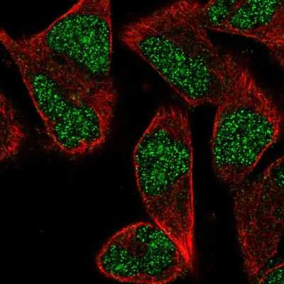 Immunocytochemistry/ Immunofluorescence: ZNF627 Antibody [NBP2-57935]