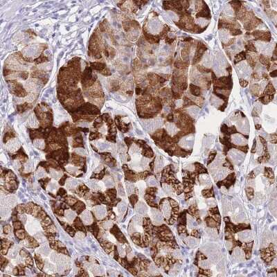 Immunohistochemistry-Paraffin: ZNF627 Antibody [NBP2-31893]
