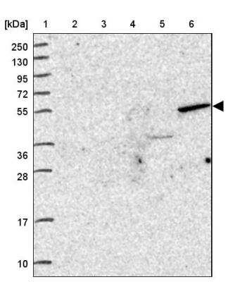 Western Blot: ZNF627 Antibody [NBP2-31893]