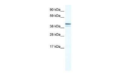 Western Blot: ZNF627 Antibody [NBP2-86536]