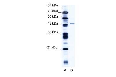 Western Blot: ZNF627 Antibody [NBP2-86537]