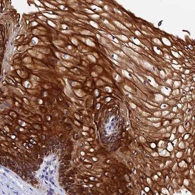 Immunohistochemistry-Paraffin: ZNF628 Antibody [NBP1-92638]