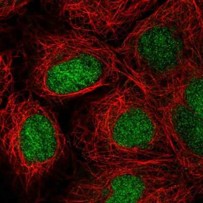 Immunocytochemistry/ Immunofluorescence: ZNF629 Antibody [NBP2-58789]