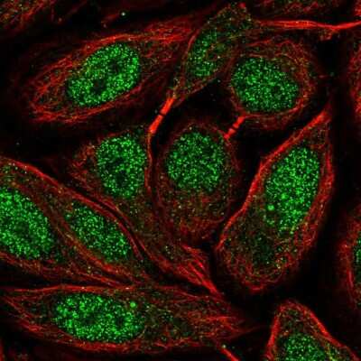 Immunocytochemistry/ Immunofluorescence: ZNF630 Antibody [NBP2-57431]