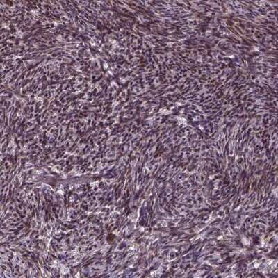 Immunohistochemistry-Paraffin: ZNF630 Antibody [NBP2-55223]