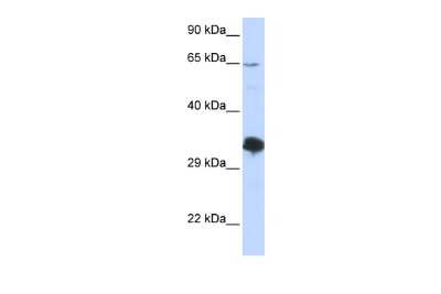 Western Blot: ZNF630 Antibody [NBP2-86539]