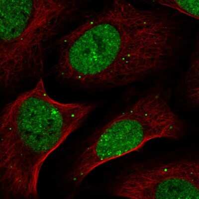 Immunocytochemistry/ Immunofluorescence: ZNF638 Antibody [NBP1-82730]