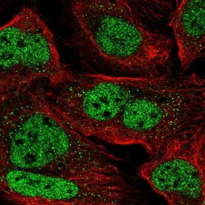 Immunocytochemistry/ Immunofluorescence: ZNF638 Antibody [NBP2-56119]