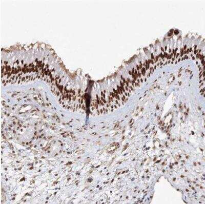 Immunohistochemistry-Paraffin: ZNF638 Antibody [NBP1-82730]