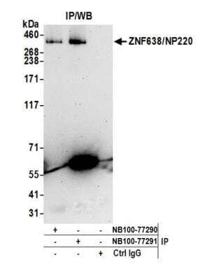 Immunoprecipitation: ZNF638 Antibody [NB100-77291]