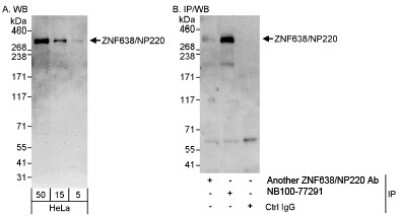 Western Blot: ZNF638 Antibody [NB100-77291]