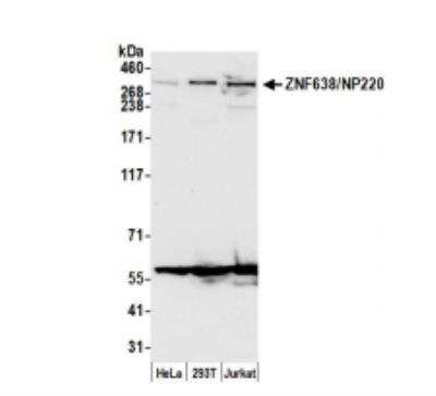 Western Blot: ZNF638 Antibody [NB100-77291]