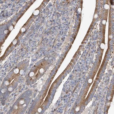 Immunohistochemistry-Paraffin: ZNF641 Antibody [NBP1-82022]
