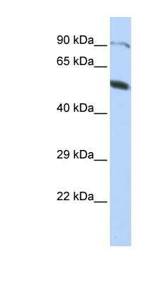 Western Blot: ZNF641 Antibody [NBP1-80402]