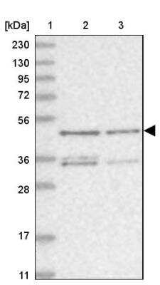 Western Blot: ZNF641 Antibody [NBP1-82022]