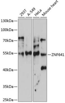 Western Blot: ZNF641 AntibodyAzide and BSA Free [NBP2-94218]