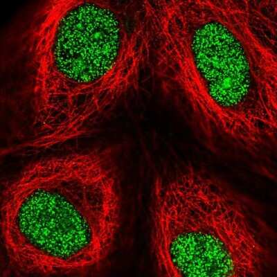 Immunocytochemistry/ Immunofluorescence: ZNF642 Antibody [NBP2-58691]