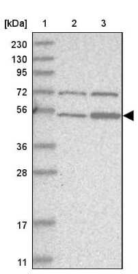 Western Blot: ZNF642 Antibody [NBP1-82215]