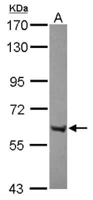 Western Blot: ZNF642 Antibody [NBP2-21036]