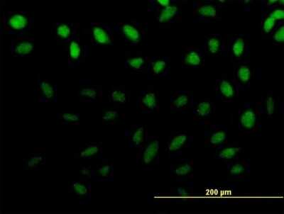 Immunocytochemistry/ Immunofluorescence: ZNF643 Antibody [H00065243-B01P]