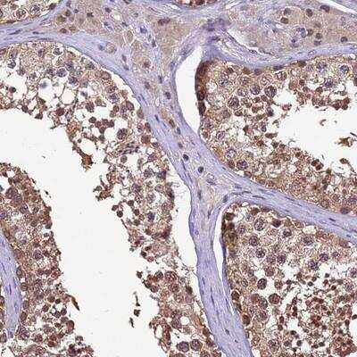 Immunohistochemistry-Paraffin: ZNF643 Antibody [NBP1-92639]