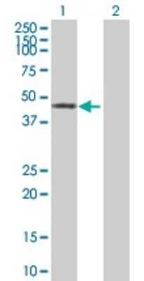 Western Blot: ZNF643 Antibody [H00065243-B01P]