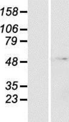 Western Blot: ZNF643 Overexpression Lysate [NBP2-06385]