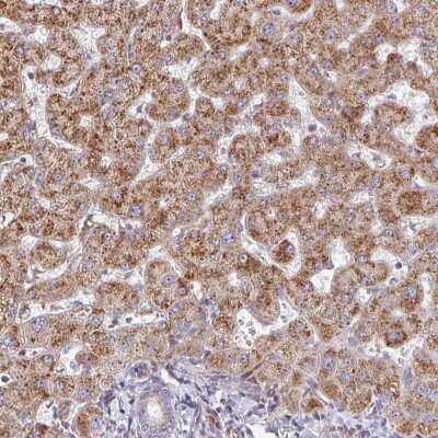 Immunohistochemistry-Paraffin: ZNF644 Antibody [NBP2-34084]