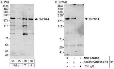 Western Blot: ZNF644 Antibody [NBP1-78195]