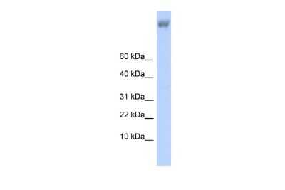 Western Blot: ZNF644 Antibody [NBP2-86541]