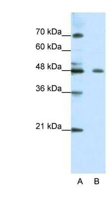 Western Blot: ZNF645 Antibody [NBP1-80163]