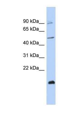 Western Blot: ZNF645 Antibody [NBP1-80410]