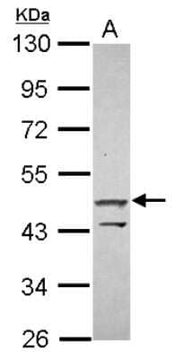 Western Blot: ZNF645 Antibody [NBP2-21037]