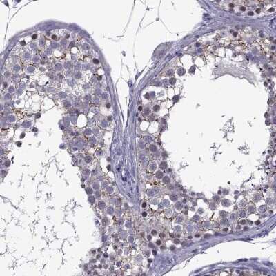 Immunocytochemistry/ Immunofluorescence: ZNF646 Antibody [NBP2-68841]