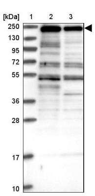 Western Blot: ZNF646 Antibody [NBP1-81522]