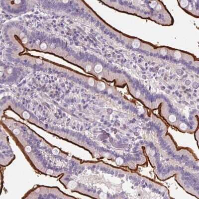 Immunohistochemistry: ZNF648 Antibody [NBP2-49102]