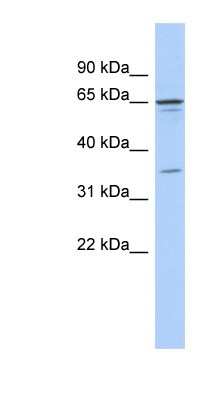 Western Blot: ZNF648 Antibody [NBP1-79353]