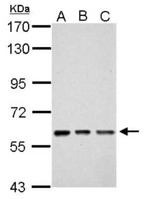 Western Blot: ZNF649 Antibody [NBP2-21038]