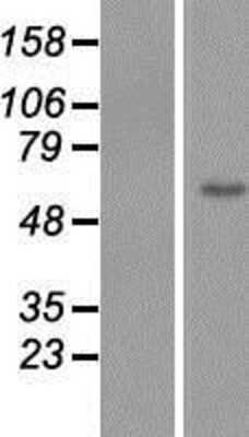 Western Blot: ZNF649 Overexpression Lysate [NBP2-06388]