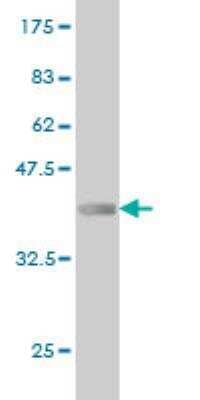 Western Blot: ZNF650 Antibody (5A10) [H00130507-M01]