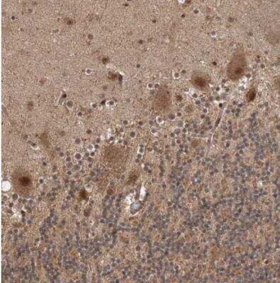 Immunohistochemistry-Paraffin: ZNF650 Antibody [NBP1-87996]