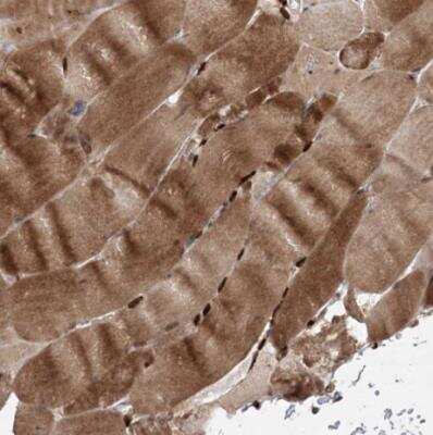 Immunohistochemistry-Paraffin: ZNF650 Antibody [NBP1-87996]
