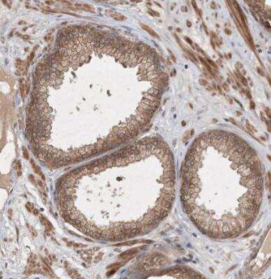 Immunohistochemistry-Paraffin: ZNF650 Antibody [NBP1-87996]