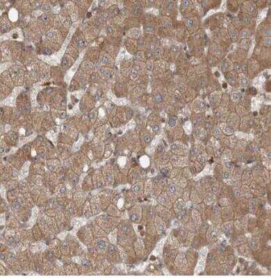 Immunohistochemistry-Paraffin: ZNF650 Antibody [NBP1-87996]