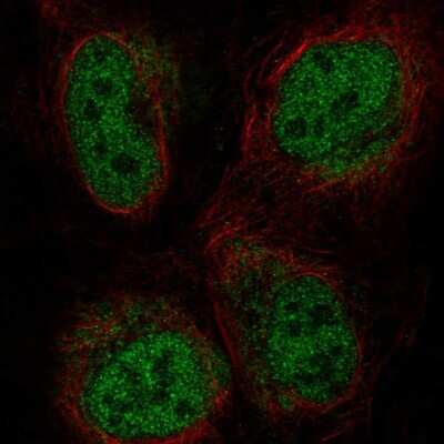 Immunocytochemistry/ Immunofluorescence: ZNF651 Antibody [NBP2-56064]